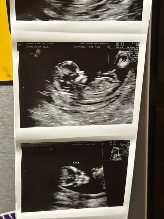 Baby T pregnancy photo, March 2026