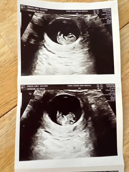 Baby T pregnancy photo, March 2026