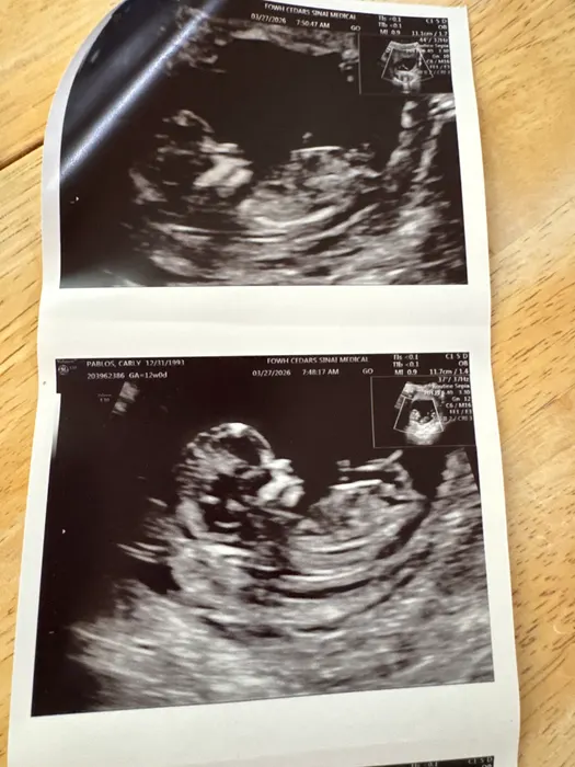 Baby T pregnancy photo, March 2026